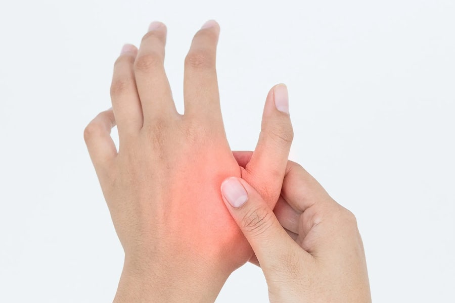 fracture phalanges et metacarpiens doigt urgences main paris ccmpo chirurgiens orthopedistes centre de chirurgie de la main poignet coude epaule paris ouest